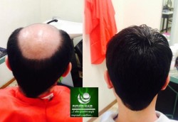 evidenza future hair