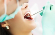 Cure odontoiatriche; un cittadino su 4 non può reimpiantare i denti perduti, ma arriva Pimos
