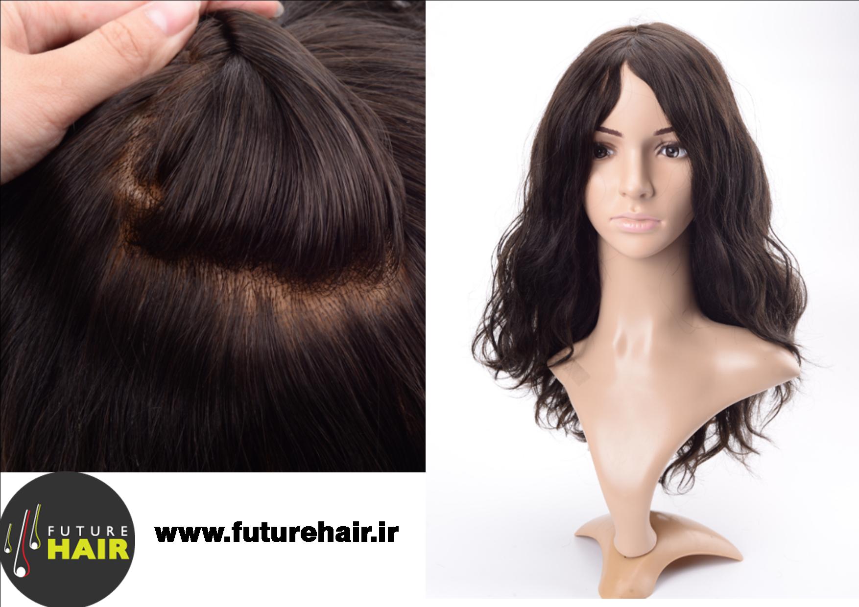 Da Future Hair arriva la protesi tricologica Liberty che risolve l'alopecia  totale o avanzata - AndradeLab.it